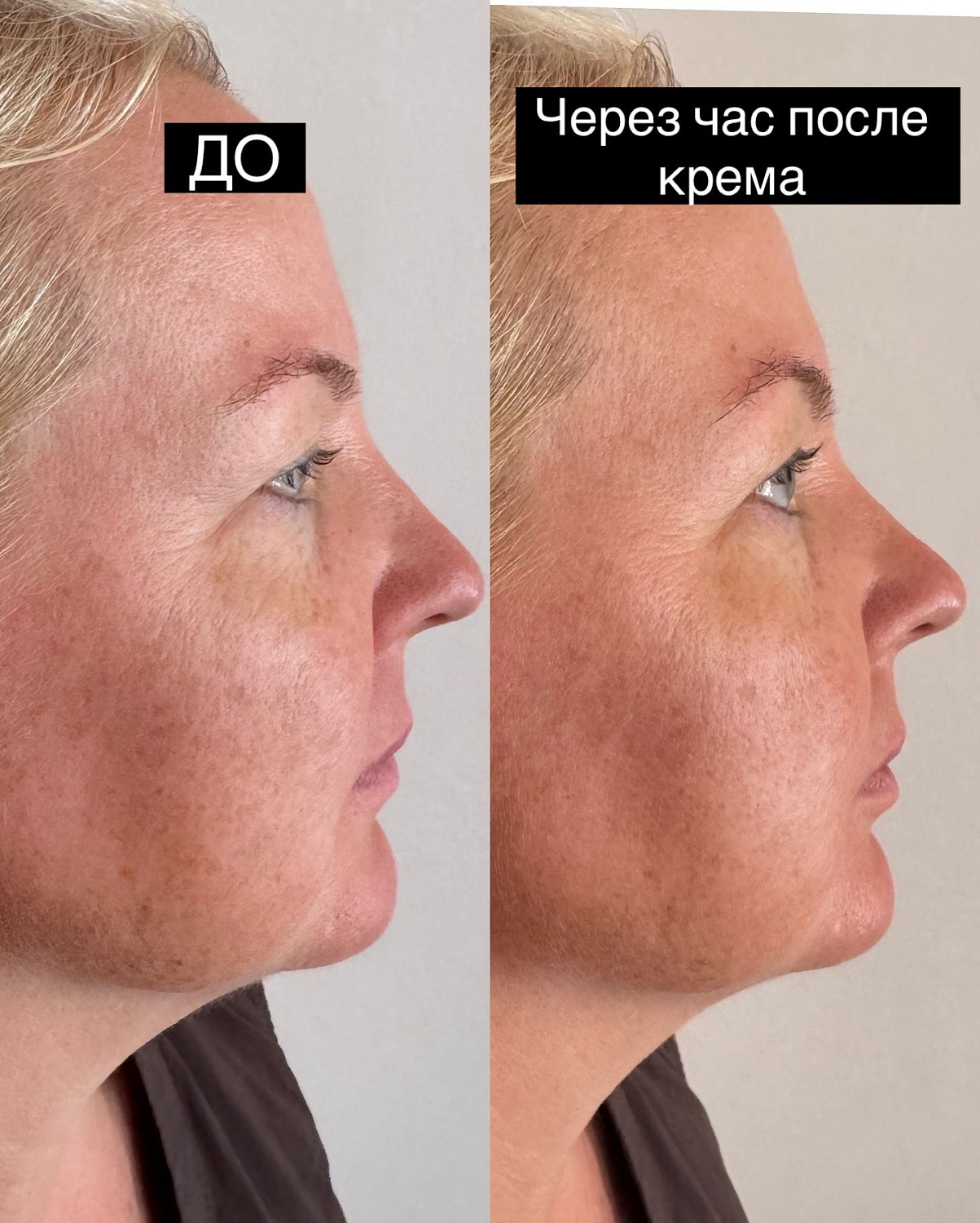 Лимфодренажный крем для лица (и для области вокруг глаз)